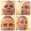 bald girl.JPG
